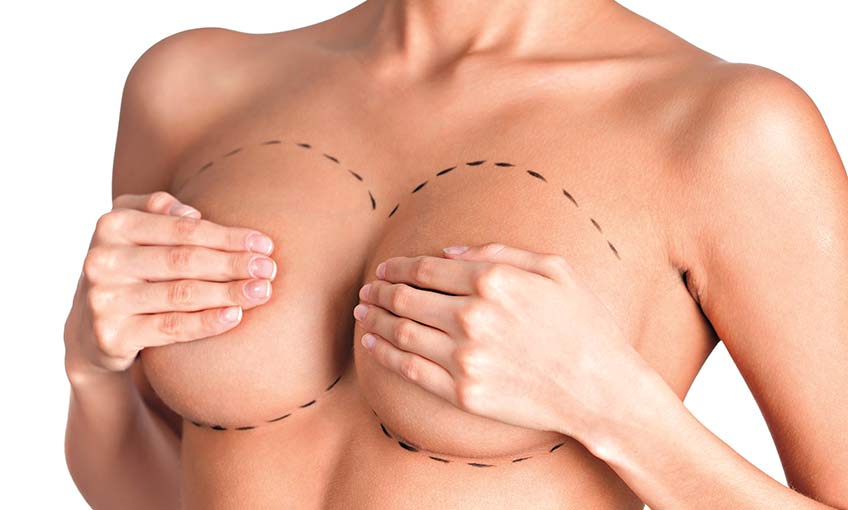 Meme yapısı, kadın vücudunun estetik yapısına ve duruşuna etki ediyor