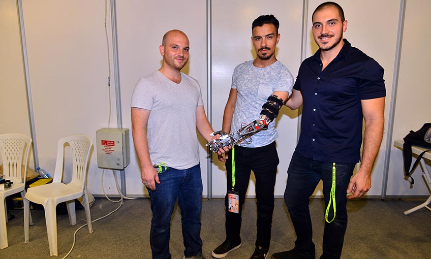 Akıllı Robotik Protez