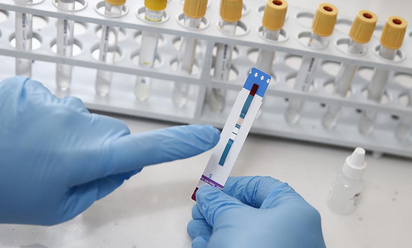 Konak Belediyesi’nden ücretsiz ve anonim HIV testi